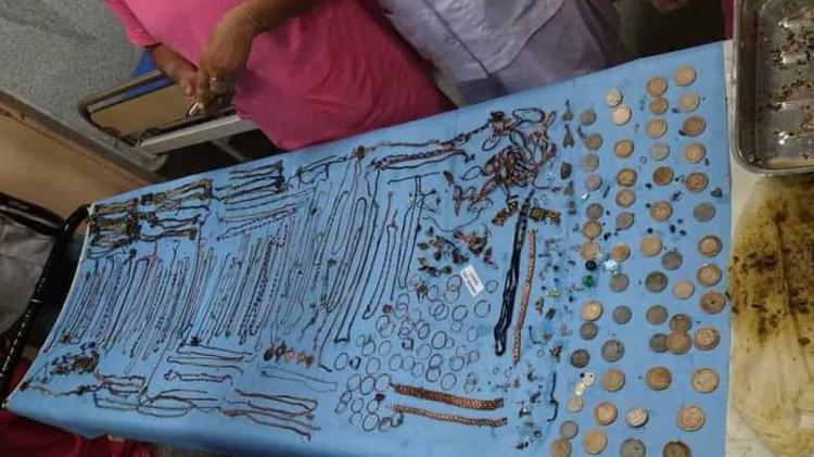 Retiradas mais de 220 peças de joalheria de estômago de doente compulsiva