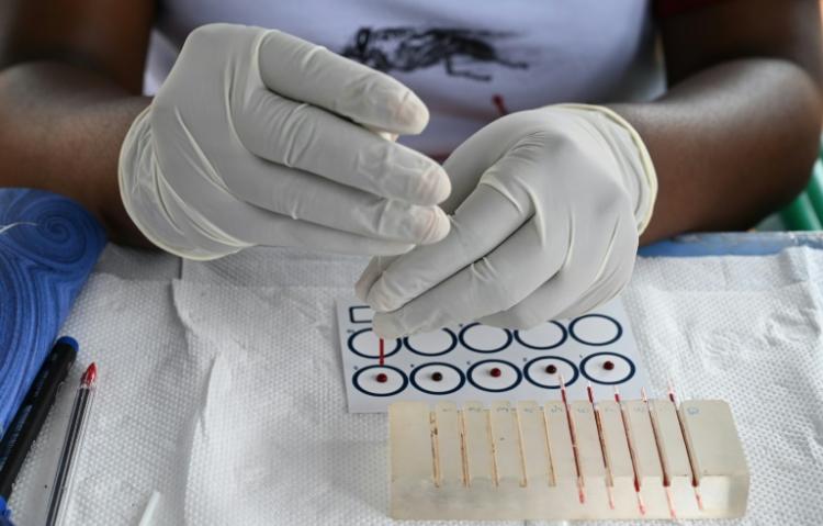 Mais de 300 milhões de pessoas sofrem de doenças raras 