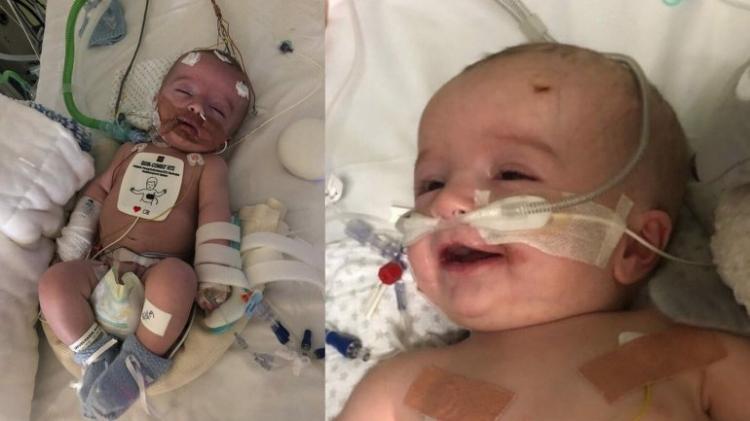 O bebé de 14 meses que acordou de um coma e sorriu para o pai. A família está a tentar angariar dinheiro para lhe salvar a vida