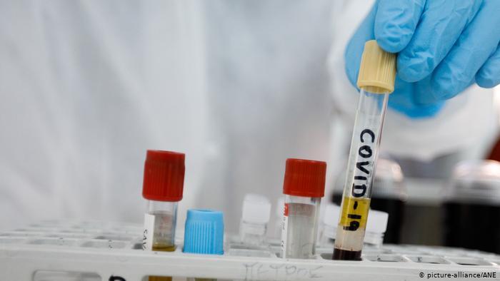 UA lança iniciativa para conter pandemia em África 